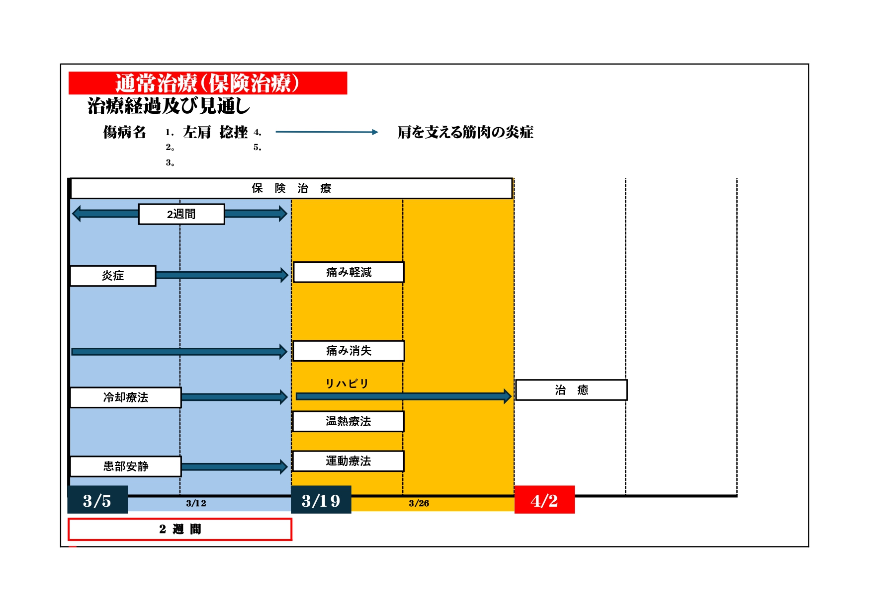 施術工程表による説明